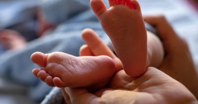 Trka sa vremenom: Bebe u Srpskoj još čekaju testiranje na spinalnu mišićnu atrofiju ! Trka sa vremenom: Bebe u Srpskoj još čekaju testiranje na spinalnu mišićnu atrofiju !