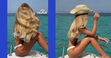 Vitamini, kolagen ili keratin – zašto dodaci prehrani za kosu nekima djeluju, a nekima ne!