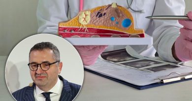 Rak dojke izlečiv u 90 odsto slučajeva kada se otkrije na vreme: Mamografija spašava živote